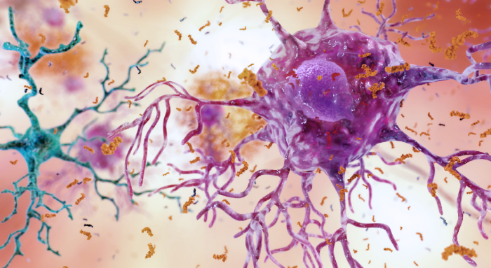 Inside Job: Fighting Alzheimer’s Disease with Your Own Immune System 